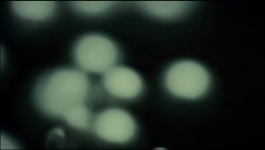 Hannibal - Season 03 - Episode 10